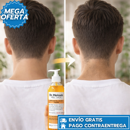 DrMelaxin GlowShot Original Formula: Exfoliación  Iluminación Instantánea.